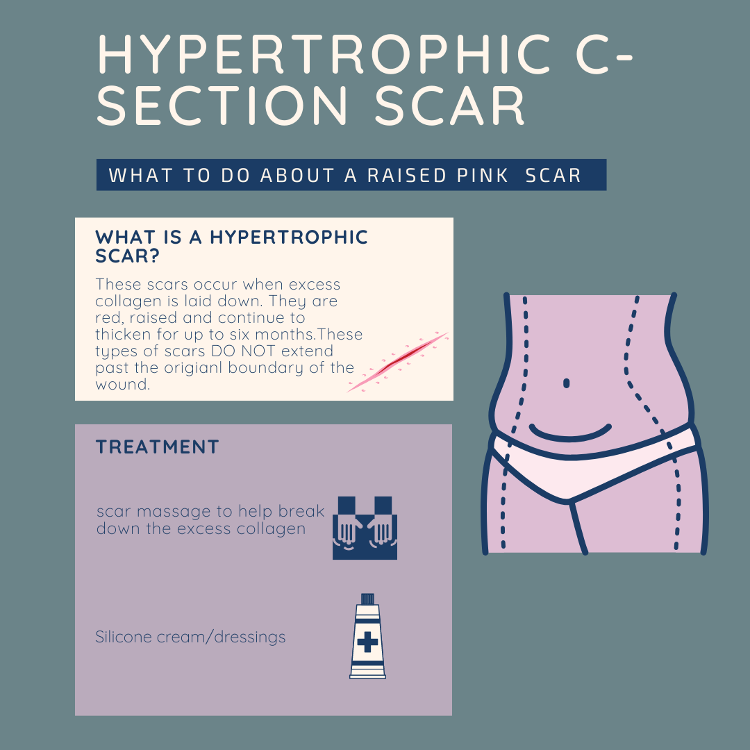 c section scar recovery